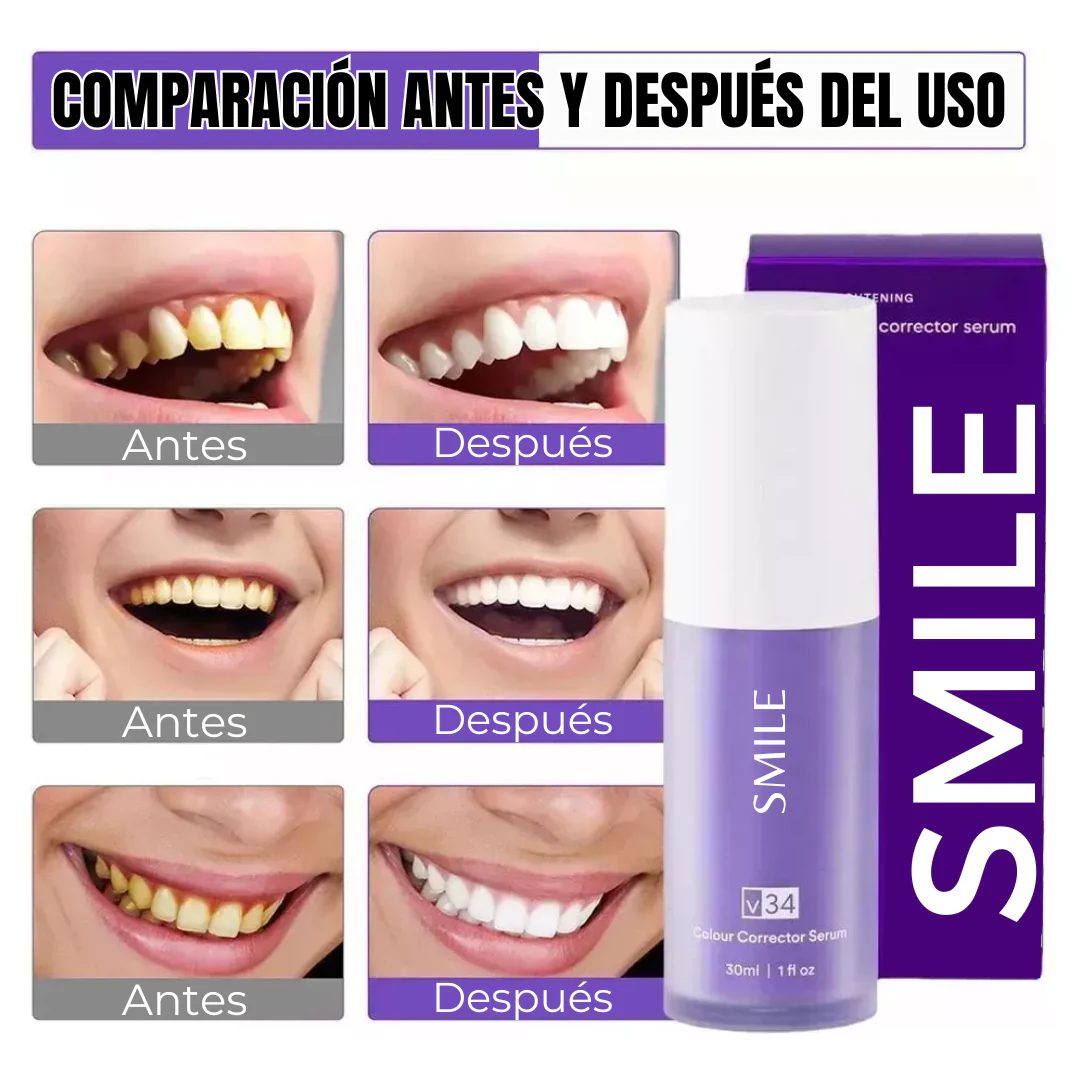 Blanqueador Dental SMILE V34 ✓ 1 + 1 Gratis