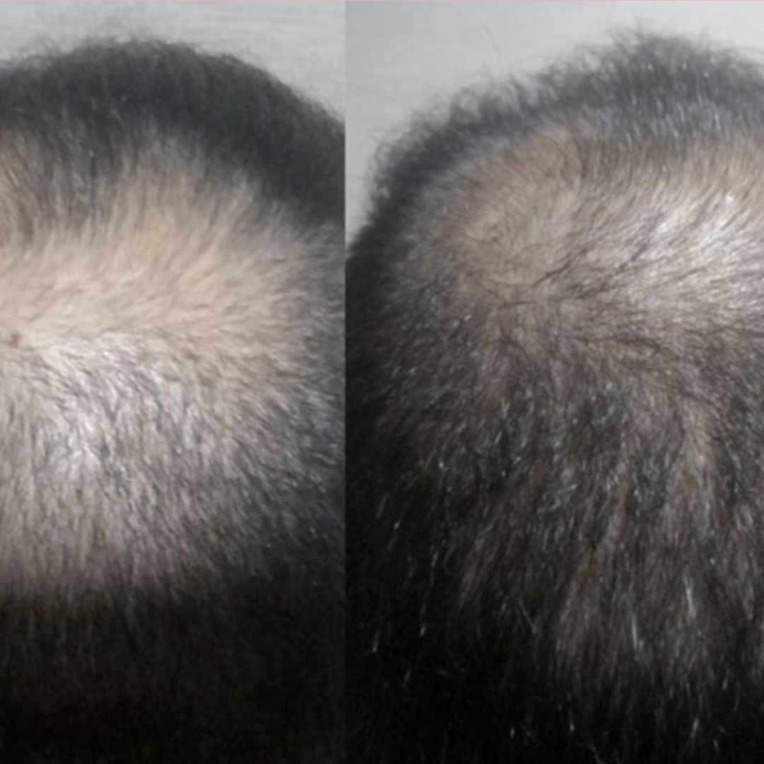 Loción para el cabello Original Green Wealth Neo ¥ ¡Compre 1 y reciba 2!