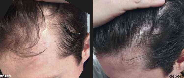 Loción para el cabello Original Green Wealth Neo ¥ ¡Compre 1 y reciba 2!