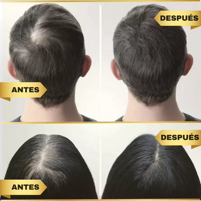 Loción para el cabello Original Green Wealth Neo ¥ ¡Compre 1 y reciba 2!