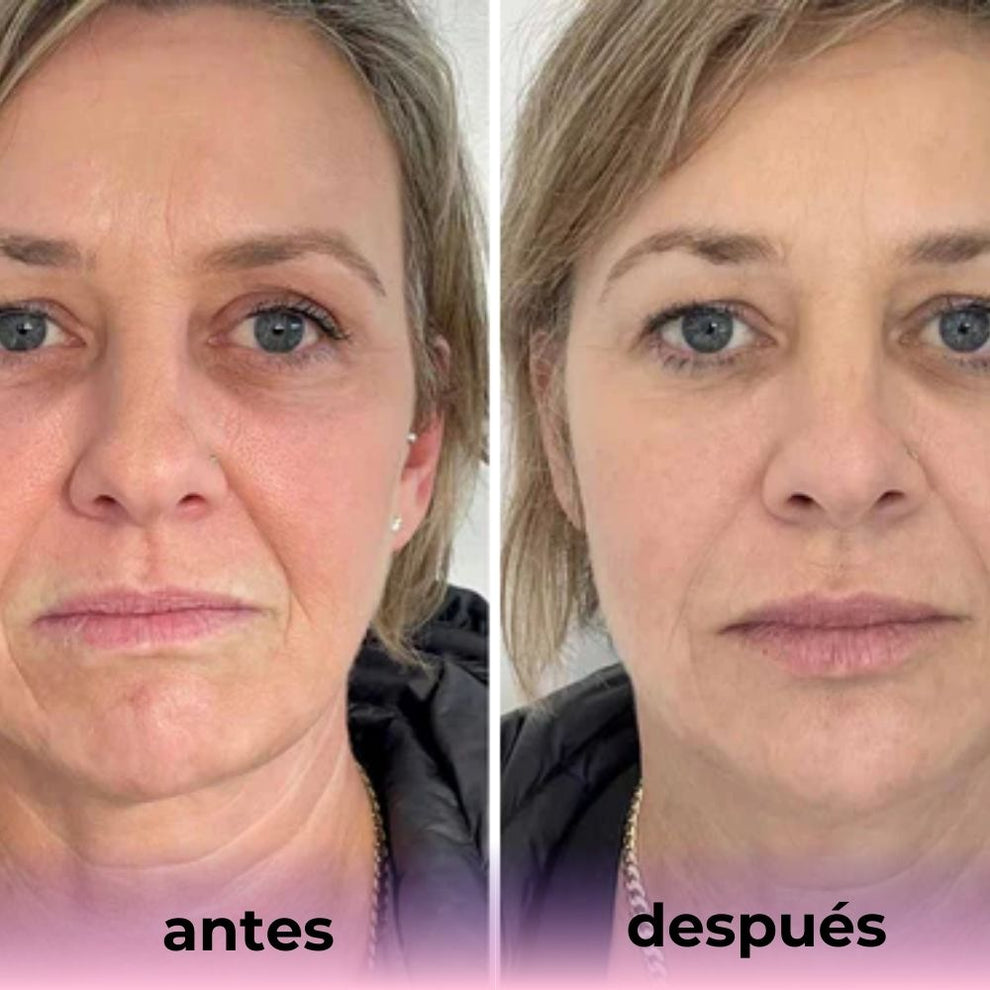Mascarilla de Bio-Colágeno ( PACK DE 6 UNIDADES )