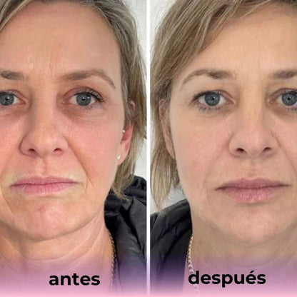 Mascarilla de Bio-Colágeno ( PACK DE 6 UNIDADES )