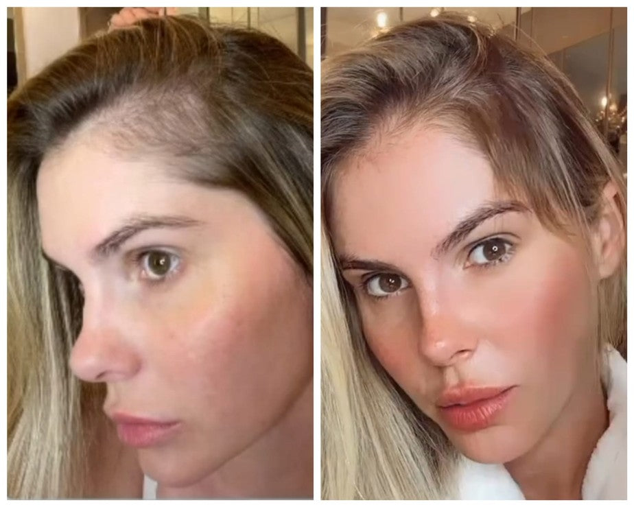 Loción para el cabello Original Green Wealth Neo ¥ ¡Compre 1 y reciba 2!