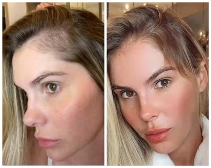 Loción para el cabello Original Green Wealth Neo ¥ ¡Compre 1 y reciba 2!